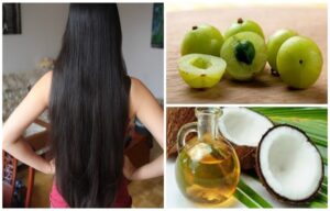 amla benefits for hair: